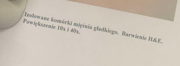 <p>są zdolne do hipertrofii - zwiększenia objętości, impuls przekazywany jets z komórki do komórki</p>