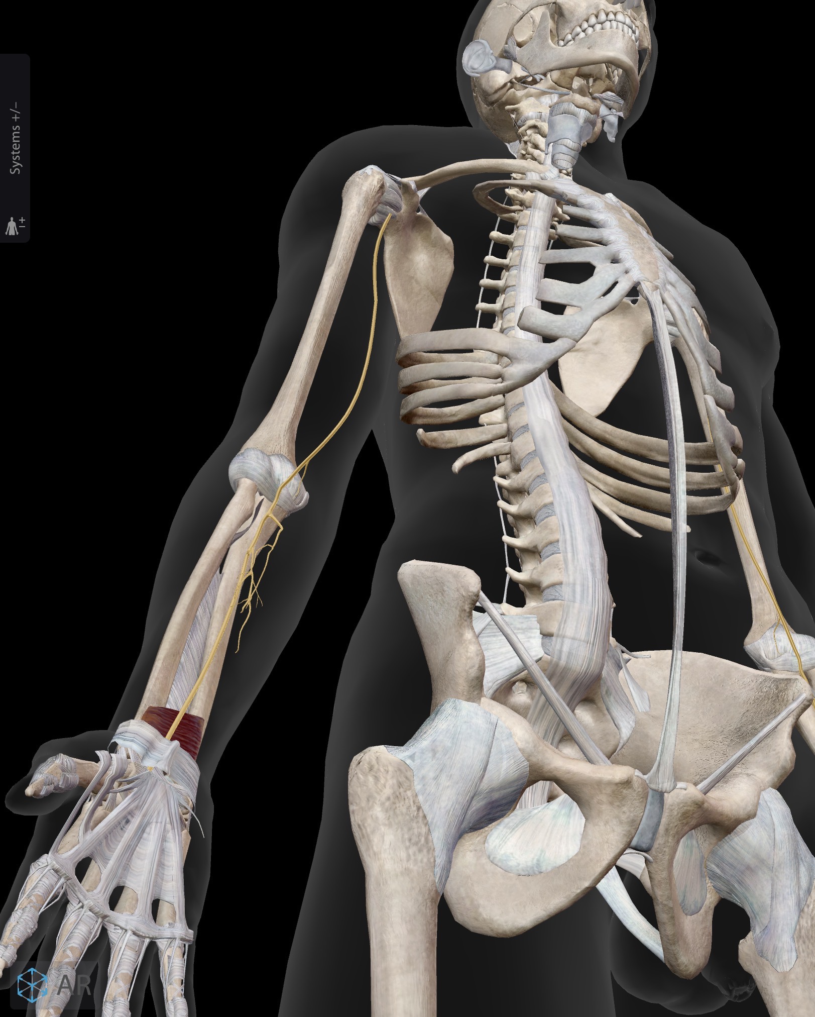 <p>Pronator quadratus</p><p>O: Distal ¼ of ulna</p><p>I: Distal ¼ of radius</p><p>A: Pronation of forearm</p><p>IN: Median nerve (C5-C8, T1)</p>