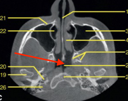 <p>identify the region indicated </p>