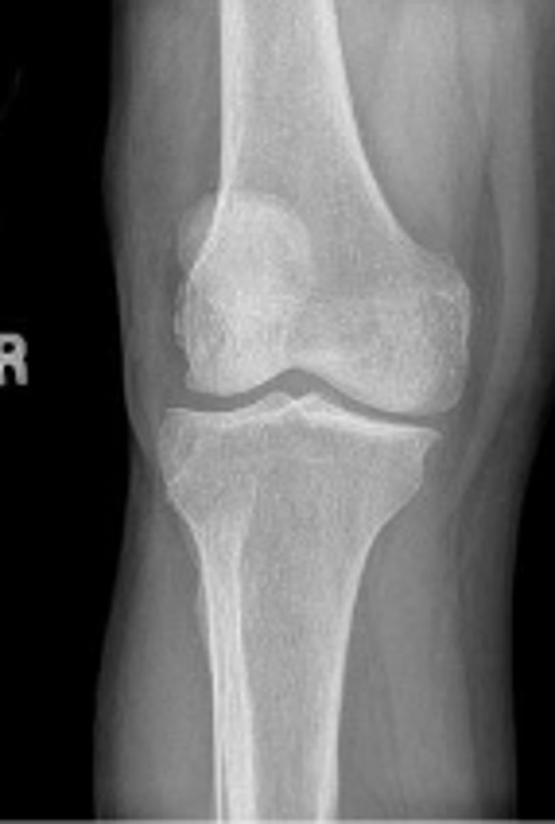 <p>What is the name of the radiographic view?</p>