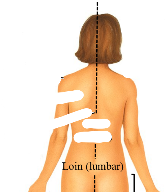 <p>lumbar</p>