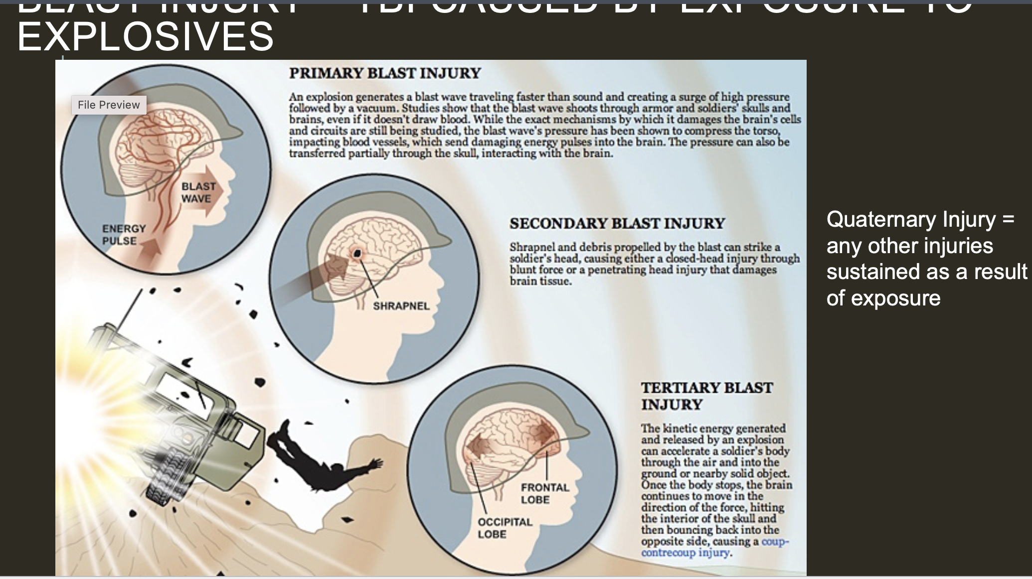 <p><span>Blast-induced traumatic brain injury (TBI) <strong><mark>can cause tau hyperphosphorylation, which may lead to chronic traumatic encephalopathy (CTE)</mark></strong>. Tau hyperphosphorylation is a hallmark of CTE, a neurodegenerative condition that can cause cognitive and behavioral changes.&nbsp;</span></p>