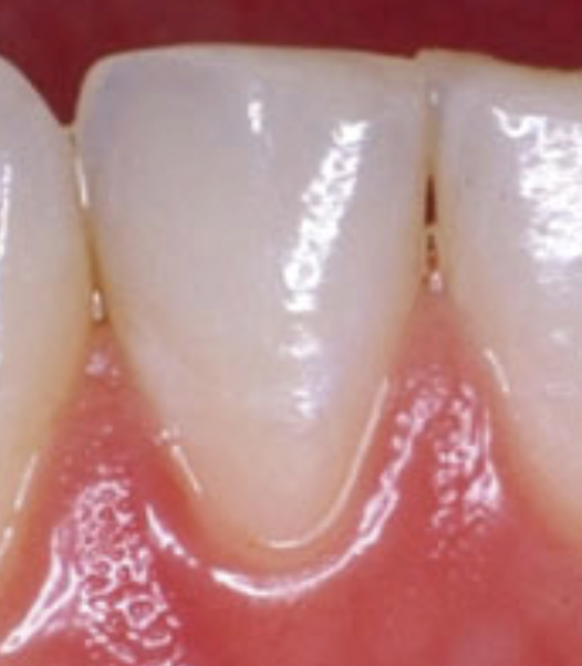 <p>Tooth #, Eruption, and Root Formation</p>