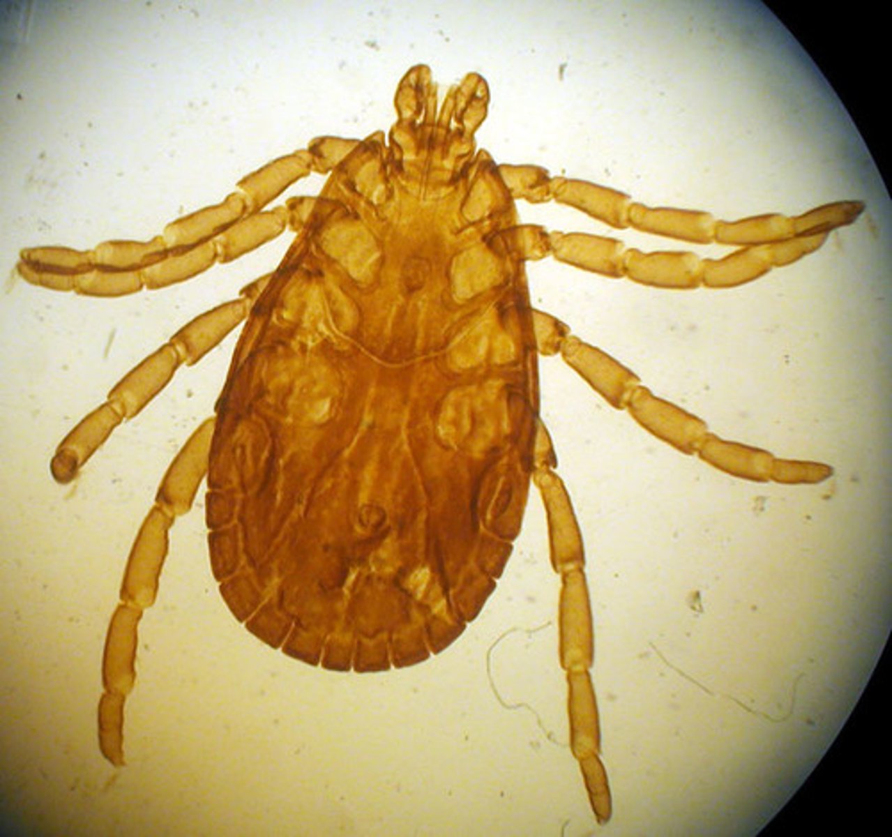 <p>Tick</p>
