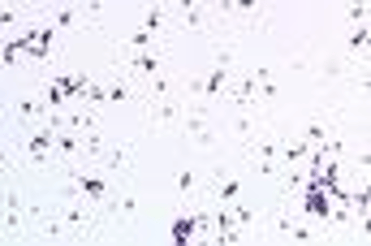 <p>A staining technique used to identify acid-fast bacteria, such as Mycobacterium species, using heat to drive the dye into the cells.</p>