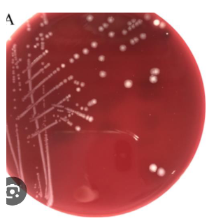 <p>this is a wound culture that has grown on your ABAP and LKV but not your BAP, what does this mean and what next step would you take</p>