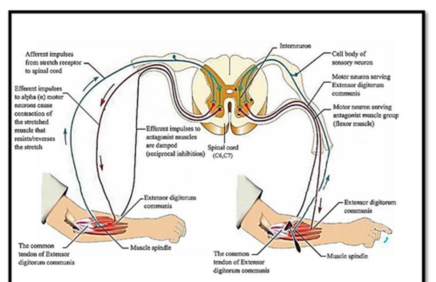 <p>Are automatic, unconscious responses to certain stimuli</p><p>A reflex arc pathway involves:</p><p>a) Receptor... e.g. dendrite</p><p>b) Sensory neuron... relays impulse to CNS</p><p>c) Reflex center (composed of interneurons) ... arc is made</p><p>d) Motor neuron... conducts impulse to the effector</p><p>e) Effector... a muscle or gland</p><p>For example, you touch a hot stove... pain receptors in the skin are stimulated and the message is sent to the sensory neuron. The message is then sent to the spinal cord... no conscious decision by the brain is needed...there at the reflex center the interneurons transmit impulses to the motor neuron, and then to the muscles (effector). The muscles contract and you withdraw your hand.</p>