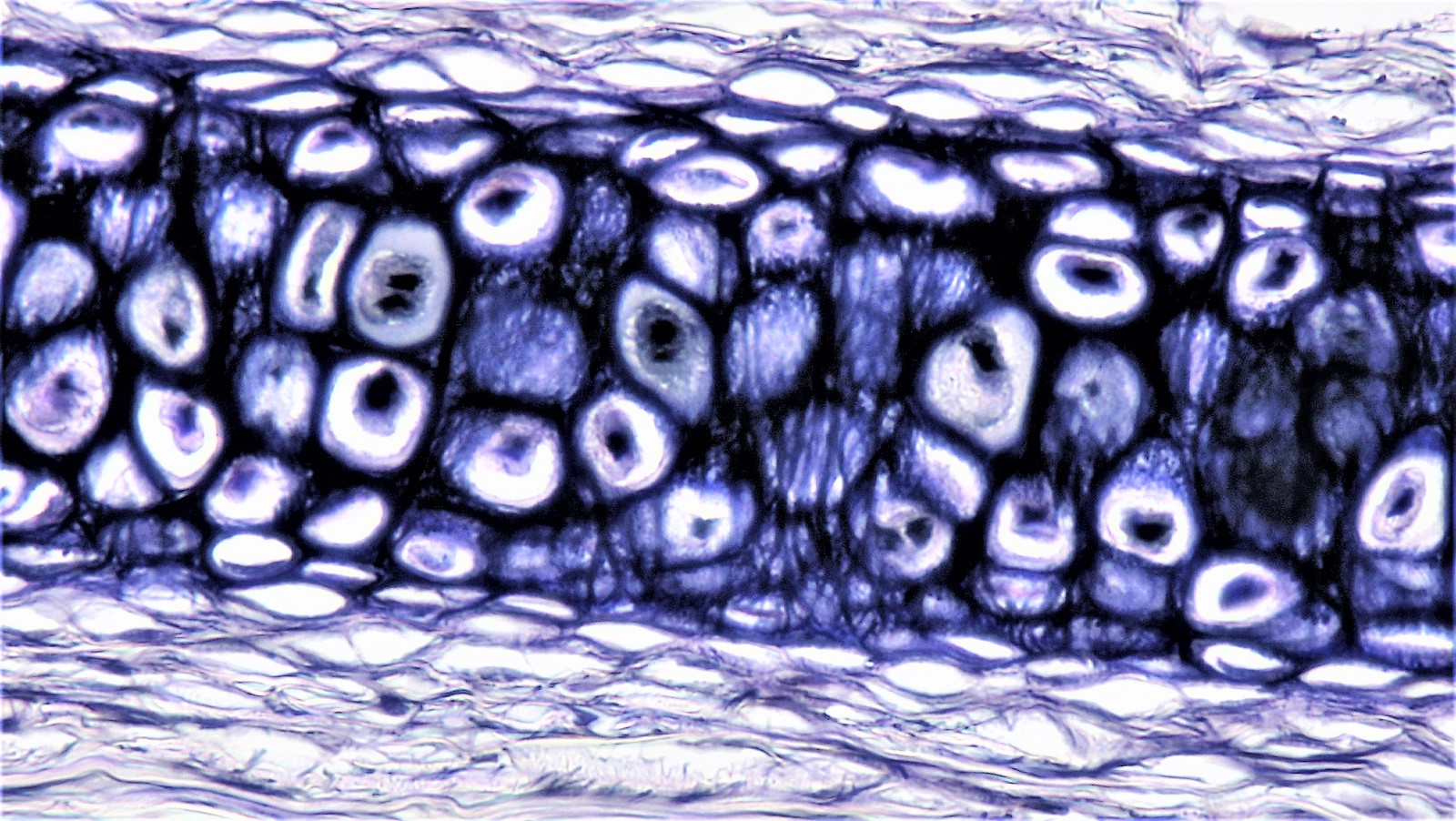 <p>elastic cartilage</p>