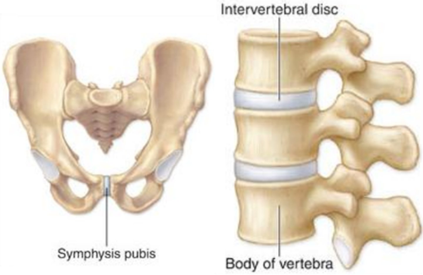 <p>Joint with limited movement</p>