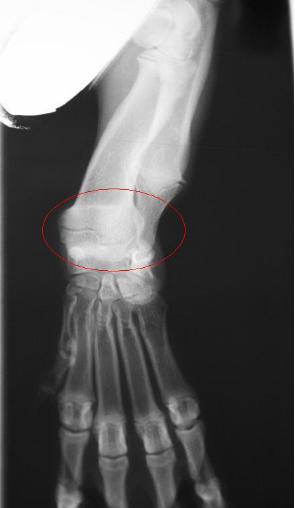 <p>Early closure of growth plates on dog can be?</p>