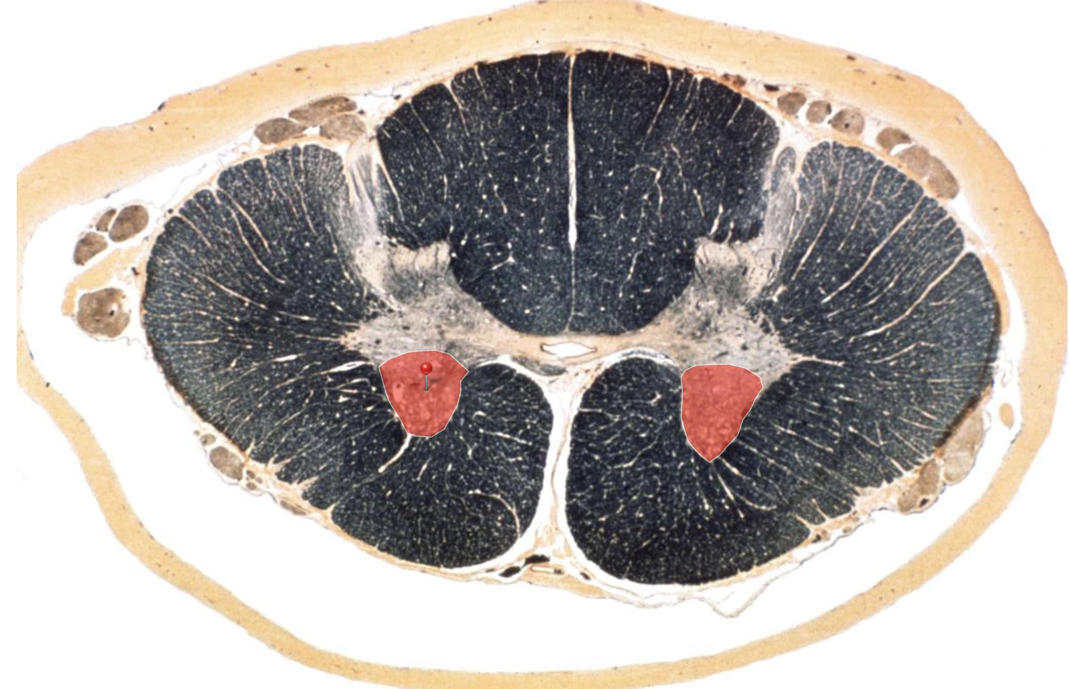 <p>Surely we know what this is and what it does?</p>