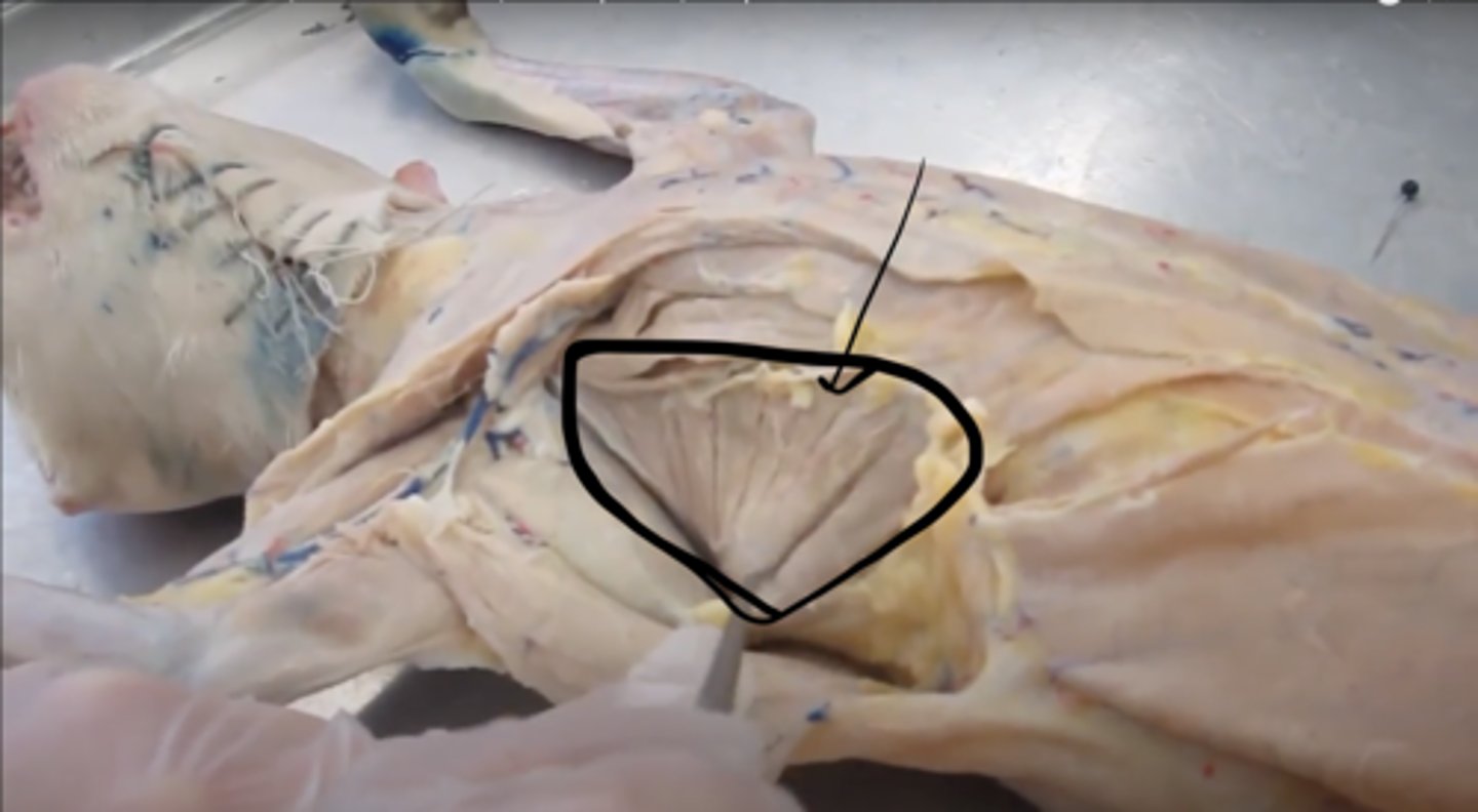 <p>name this muscle</p>