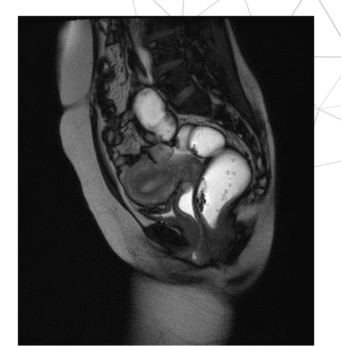 <p>Thì gì, xung gì</p>