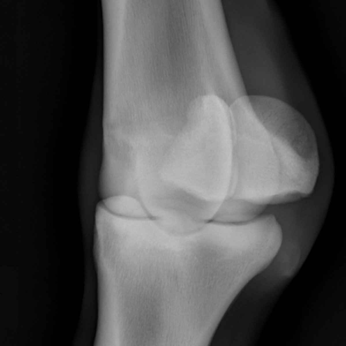 <p>ID joint and view</p>