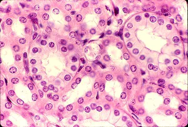 <p>simple cuboidal epithelium</p>