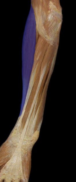 <p>Big muscle on lateral side of forearm</p>