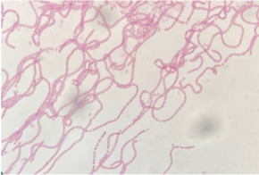 <p>Photoautotrophic (photosynthetic) and able to fix nitrogen in special cells called heterocysts. from the Domain Bacteria, group Cyanobacteria</p>
