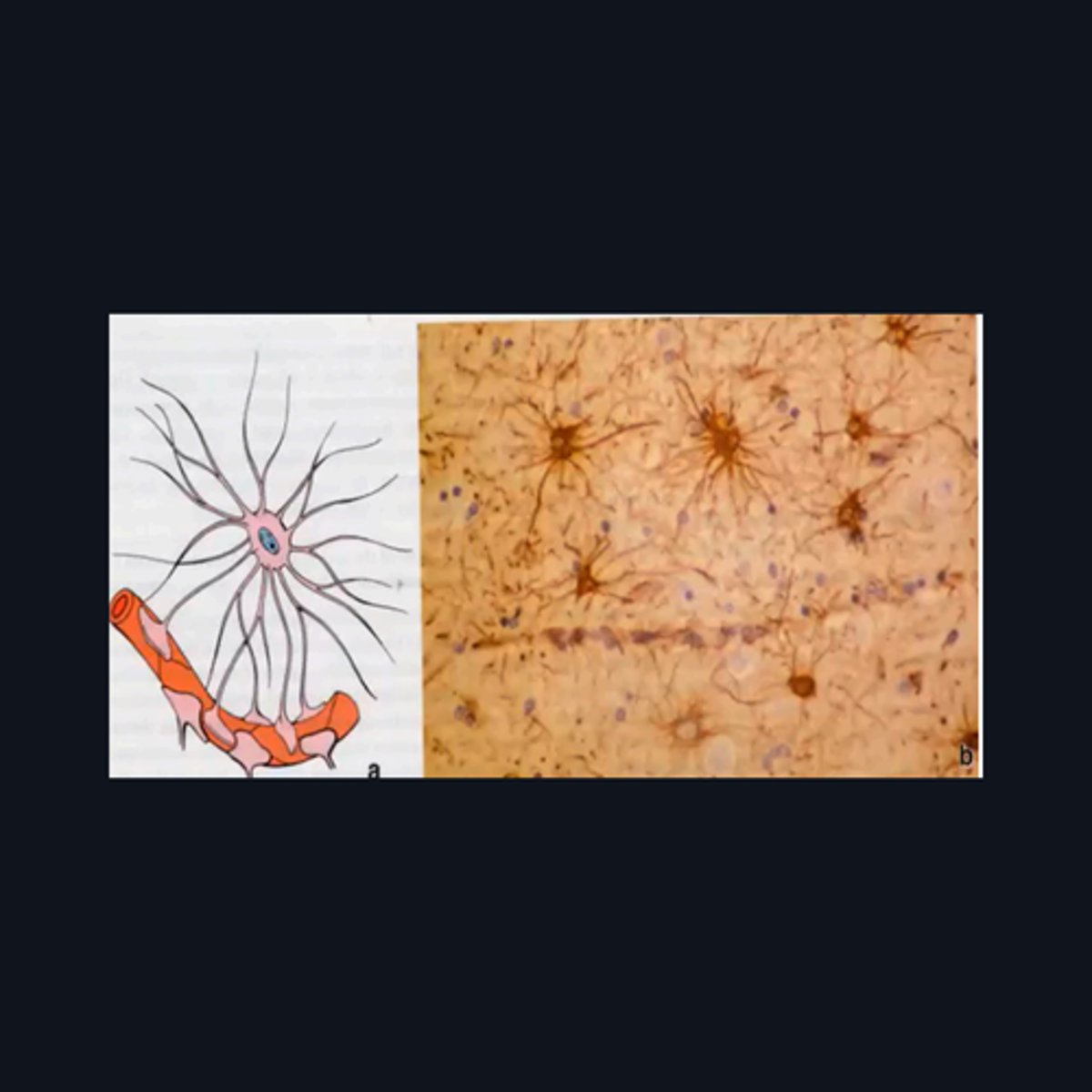 <p>This type of cell/s is located mainly on what part of the brain?</p>