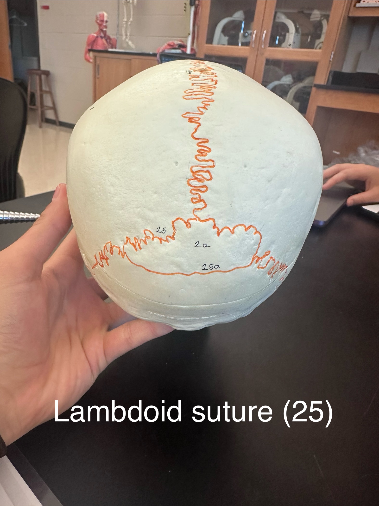 <p>Lambdoid Suture</p>
