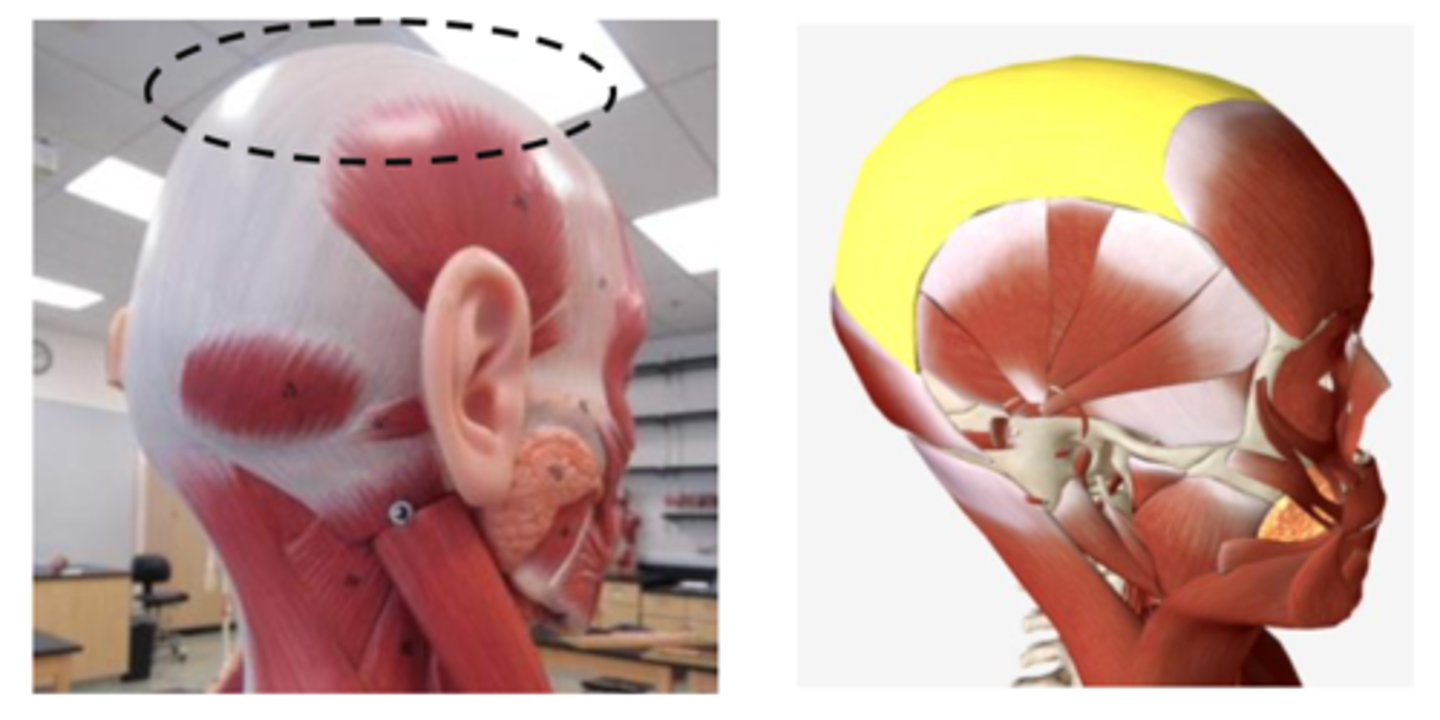 <p>37 top muscle portion of the parietal</p>