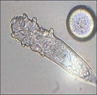 <p>what kind of mite</p>