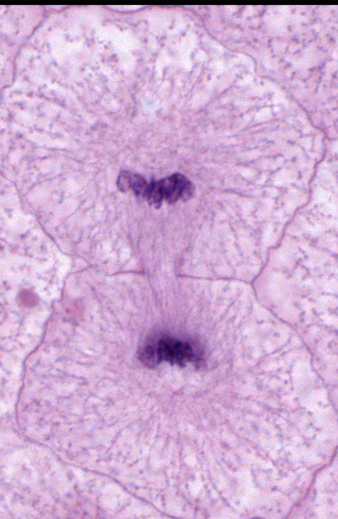 <p>Telophase</p>