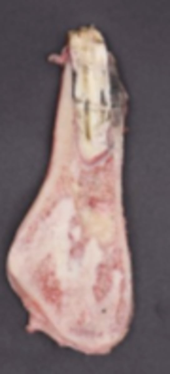 <p>Is this a benign or malignant mass?</p>