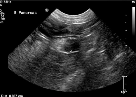 <p>-can be useful for surgical preparation</p><p>-thoracic and abdominal rads often unremarkable</p><p>-abdominal U/S can identify a mass 50% of time (better at ID'ing mets)</p><p>-abdominal CT more sensitive for ID'ing primary lesions, not specific for metastatic disease</p>