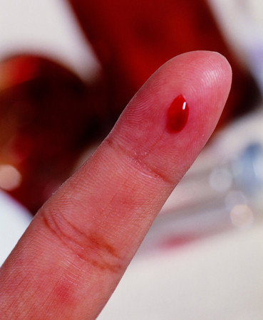 <p>ナイフは血に塗れていた<br>The knife was covered in blood.</p><p>How to say “Blood”?</p>