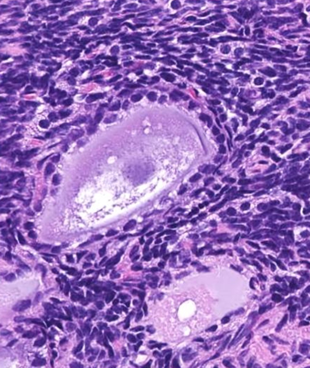 <p>_____ follicle</p>