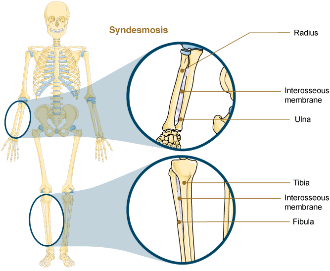 <p><span><span>A </span><strong><span>syndesmosis </span></strong><span>is a type of fibrous joint in which two parallel bones are united to each other by longer fibrous connective tissue. The gap between the bones may be narrow, with the bones joined by ligaments. The gap may also be wide and filled in by a broad sheet of connective tissue called an </span><strong><span>interosseous membrane</span></strong></span></p><p></p><p><span><span>In the forearm, the wide gap between the shaft portions of the radius and ulna bones is strongly united by an interosseous membrane. Similarly, in the leg, the shafts of the tibia and fibula are also united by an interosseous membrane.</span></span></p>