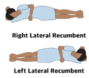 <p>Recovery Position: Laying on your side (right &nbsp;of left will be dictated in the name as applicable) with bottom arm reaching up under head, the other across body and bent to be palm on the floor and top leg bent at an angle to keep the body from rolling forward</p>