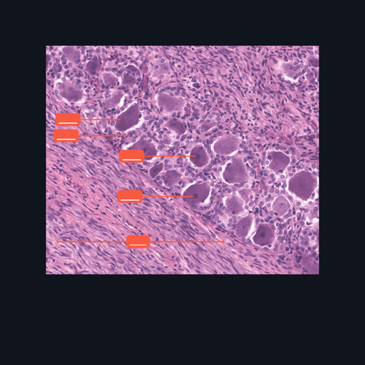 <p>Identify the parts of the spinal ganglion in high magnification.</p>