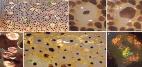 <p>What do you call the pigment-bearing cells?</p>