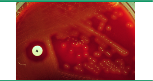(antibiotic resistance) a very small (if any at all) zone of inhibition
