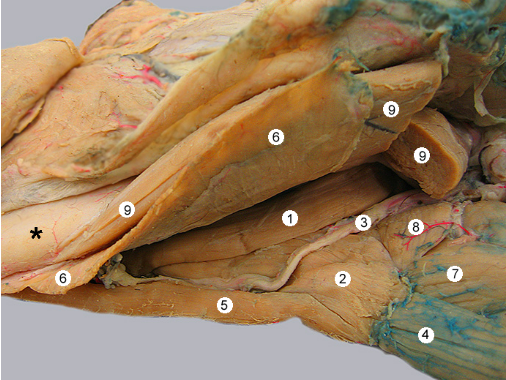 <p>this image shows two tongue muscles from a ventrolateral view.</p><p>head is facing to the left</p><p>for reference: 9 is the digastricus m, 3 is hypoglossal nerve, 6 is the mylohyoideus, 4 is the sternohyoideus</p><p>label 1,2,7</p>
