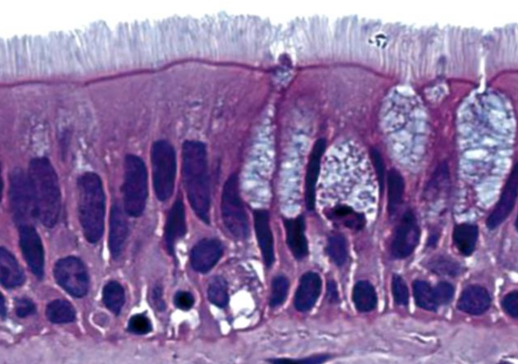 <p>Where can you find this type of epithelium?</p>