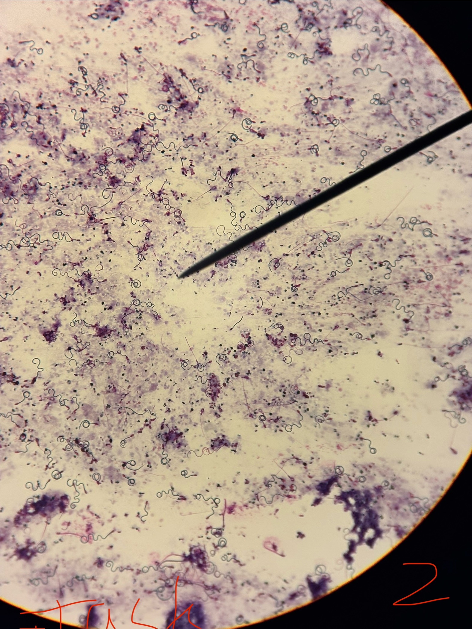 <p>cnidocytes</p>