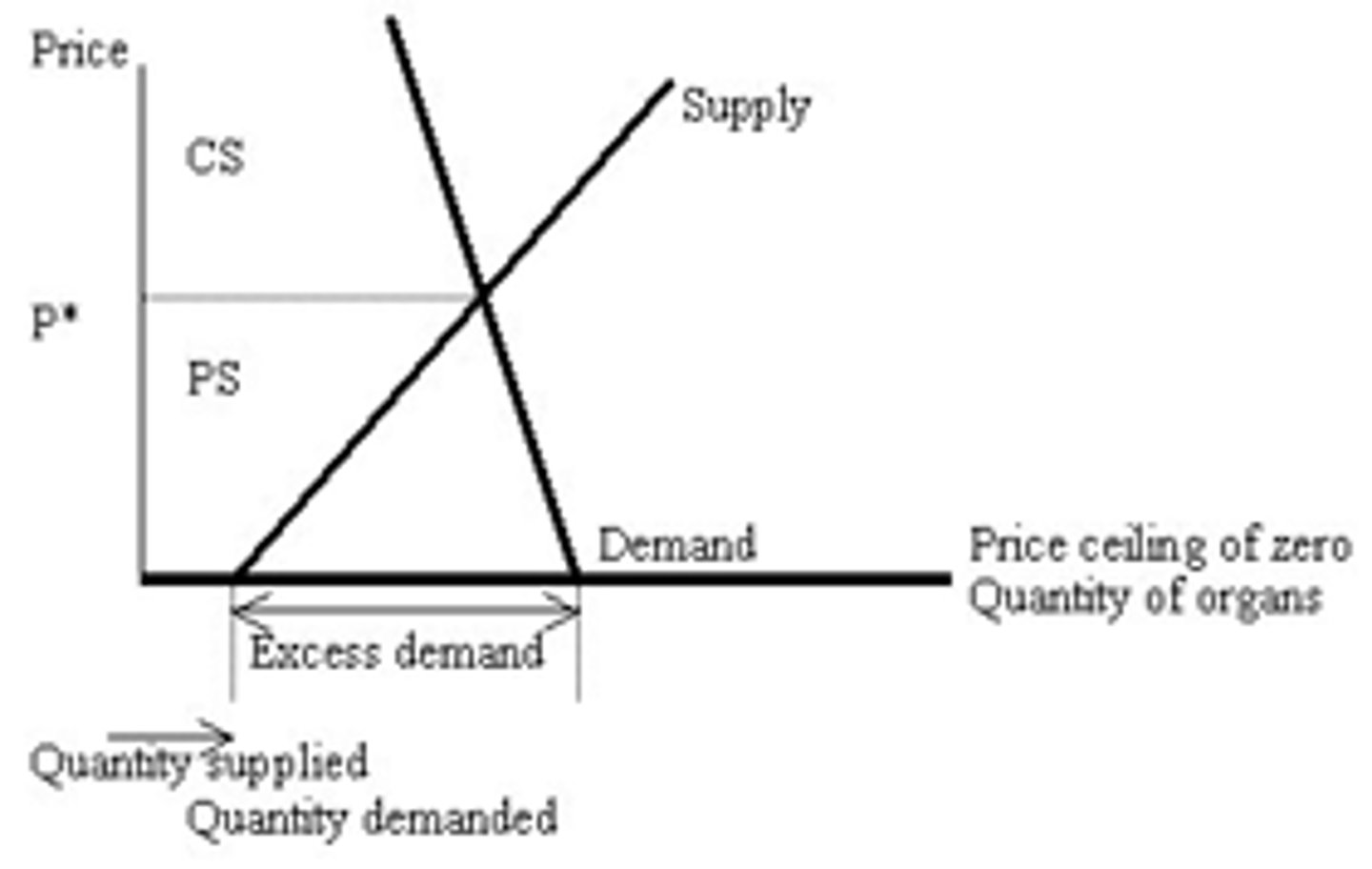 <p>a graphical representation of the quantity of a good or service supplied as a function of the price</p>