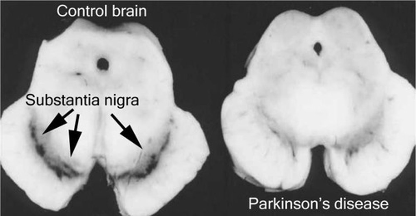 <p>Involved in the control of movement.</p>