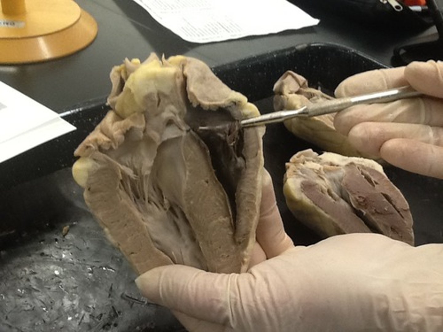 <p>Identify this valve:</p>