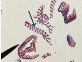 <p>In the photo, the arrow is pointing to an ______. Which is part of which Genus’s Sporophyte.</p>