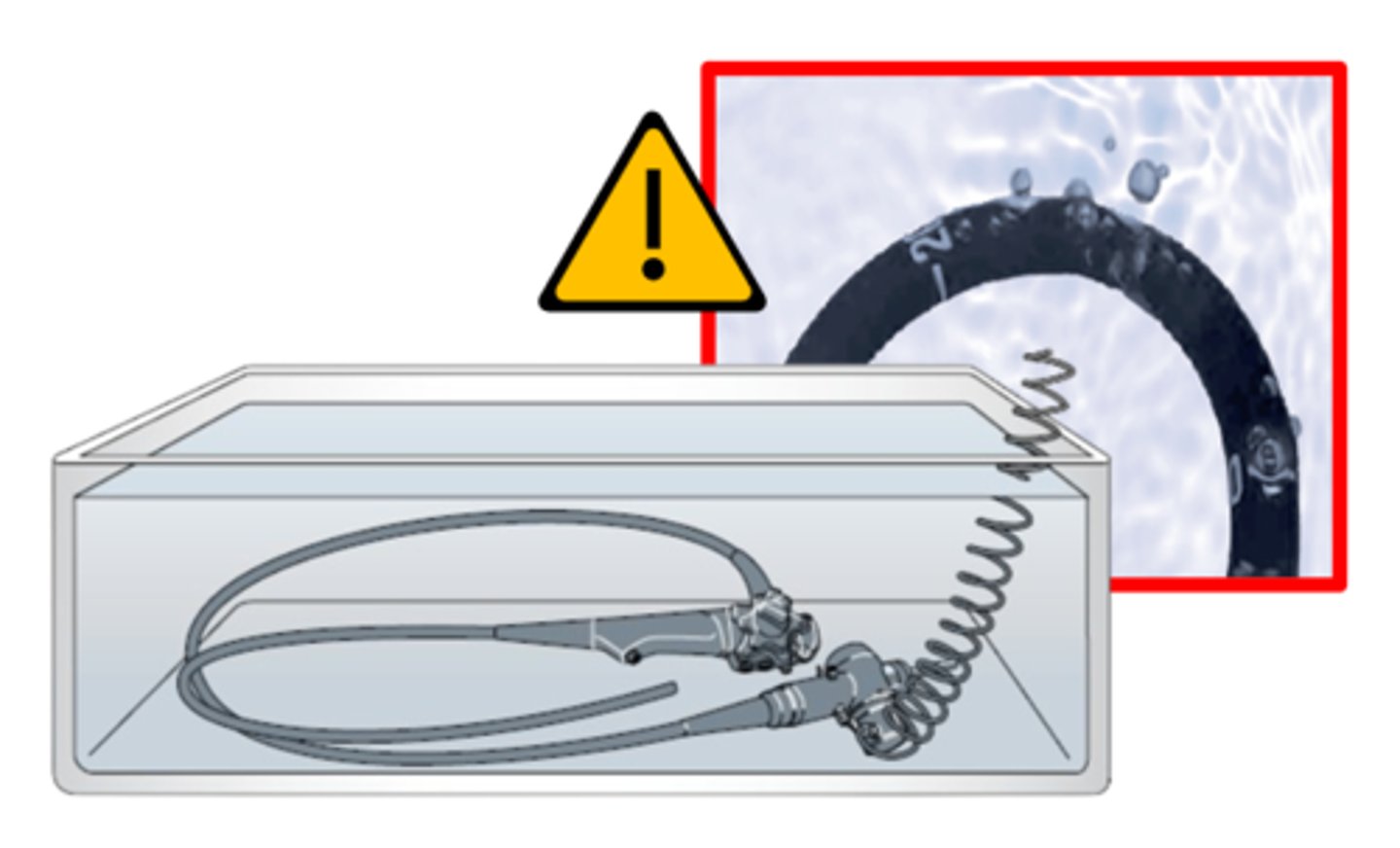 <p>a required test to ensure that an endoscope is watertight, required before submerging the device during cleaning &amp; prior to HLD or sterilization</p>
