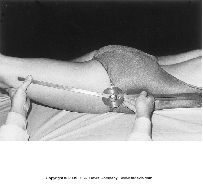 <p>•18-30 dg is normal</p><p>•Knee stays in extension – Rectus femoris</p>