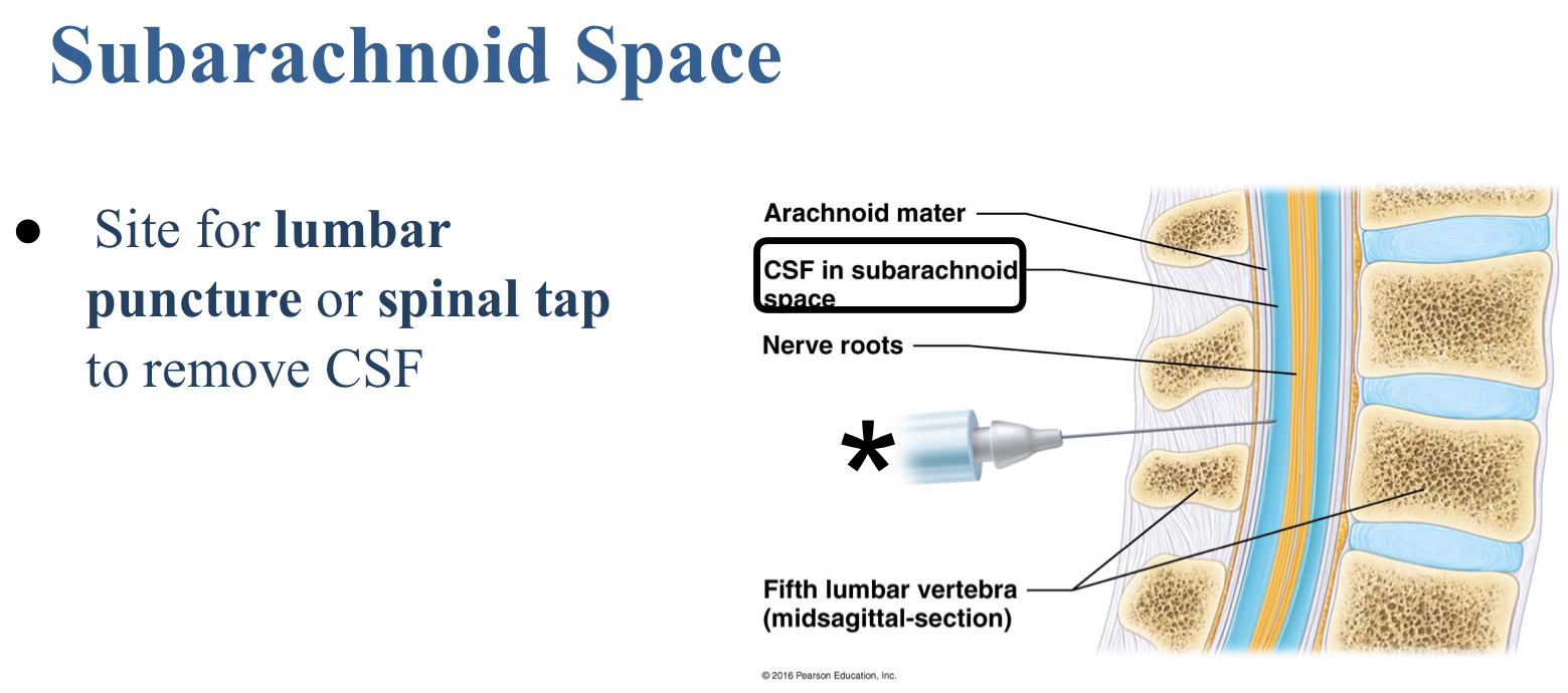 <p>Subarachnoid space</p>