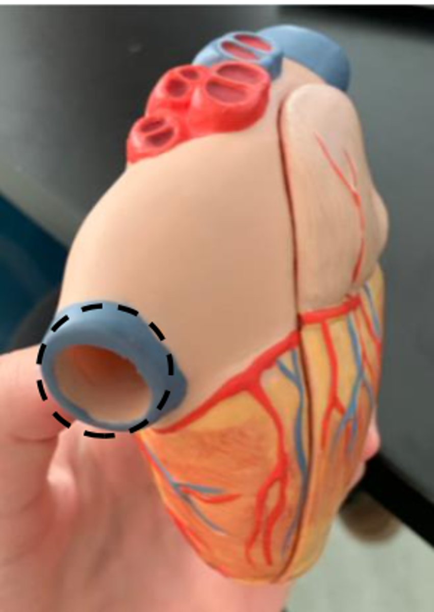 <p>inserts through the right atrium</p>