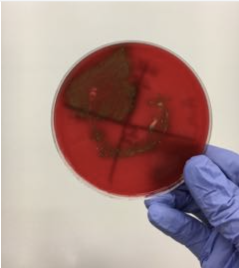 <p><span>If you got this result on blood agar and a positive optichin test result, then according to the virtual lab you have identified the bacteria as</span></p>