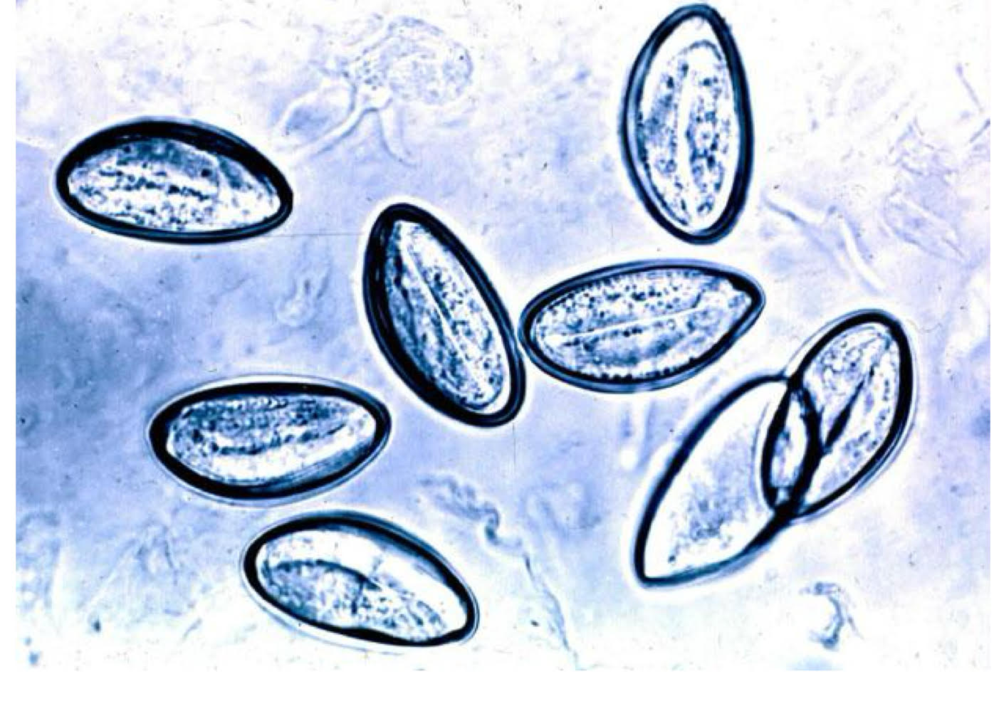 <ul><li><p>eggs </p><ul><li><p>flattened side </p></li></ul></li><li><p>adults </p><ul><li><p>alae </p></li><li><p>female → pinworm </p></li><li><p>male → curved posterior </p></li></ul></li></ul><p></p>