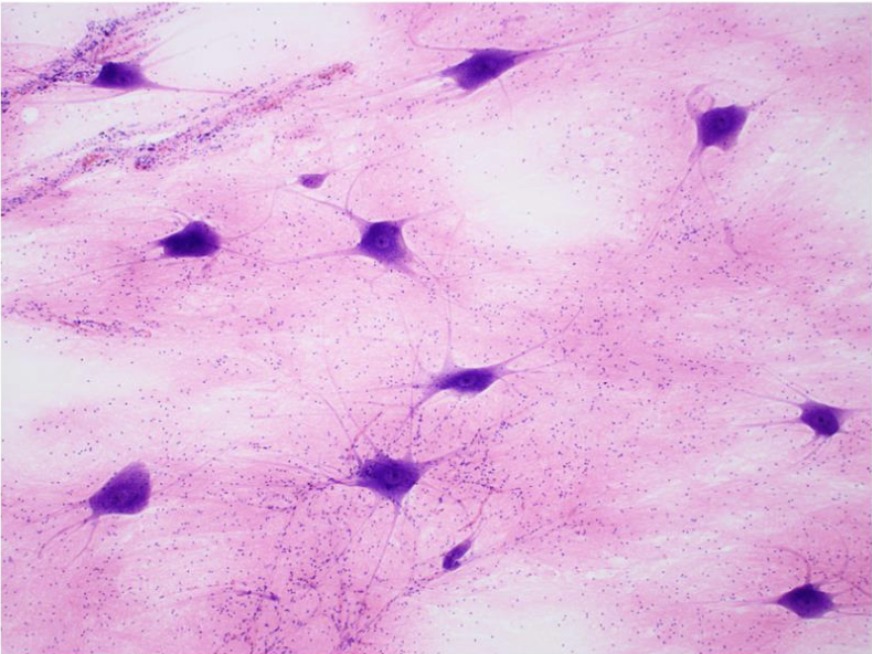 <p>what tissue is this&nbsp;</p>