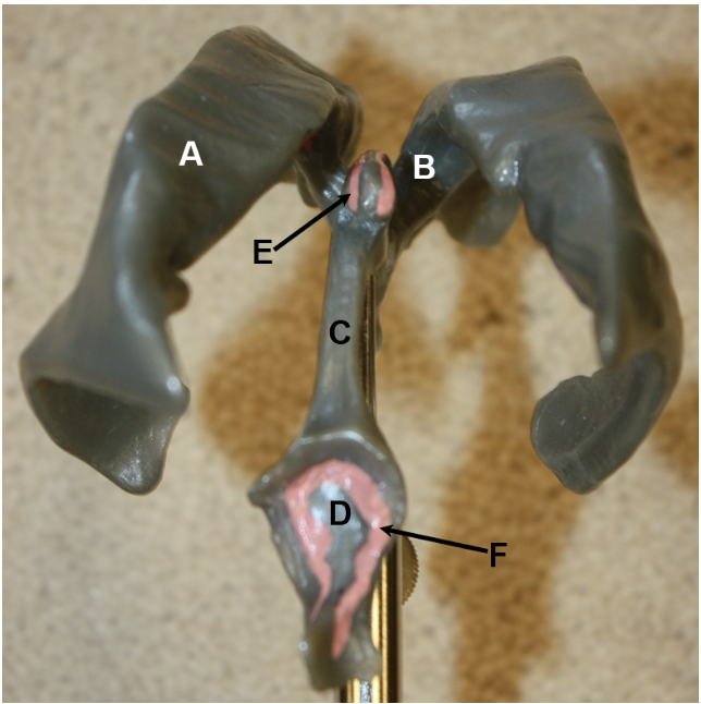 <p><span><span>In the image above (ventricular system), identify hollow structures A-D, and pink structures E-F.</span></span></p>